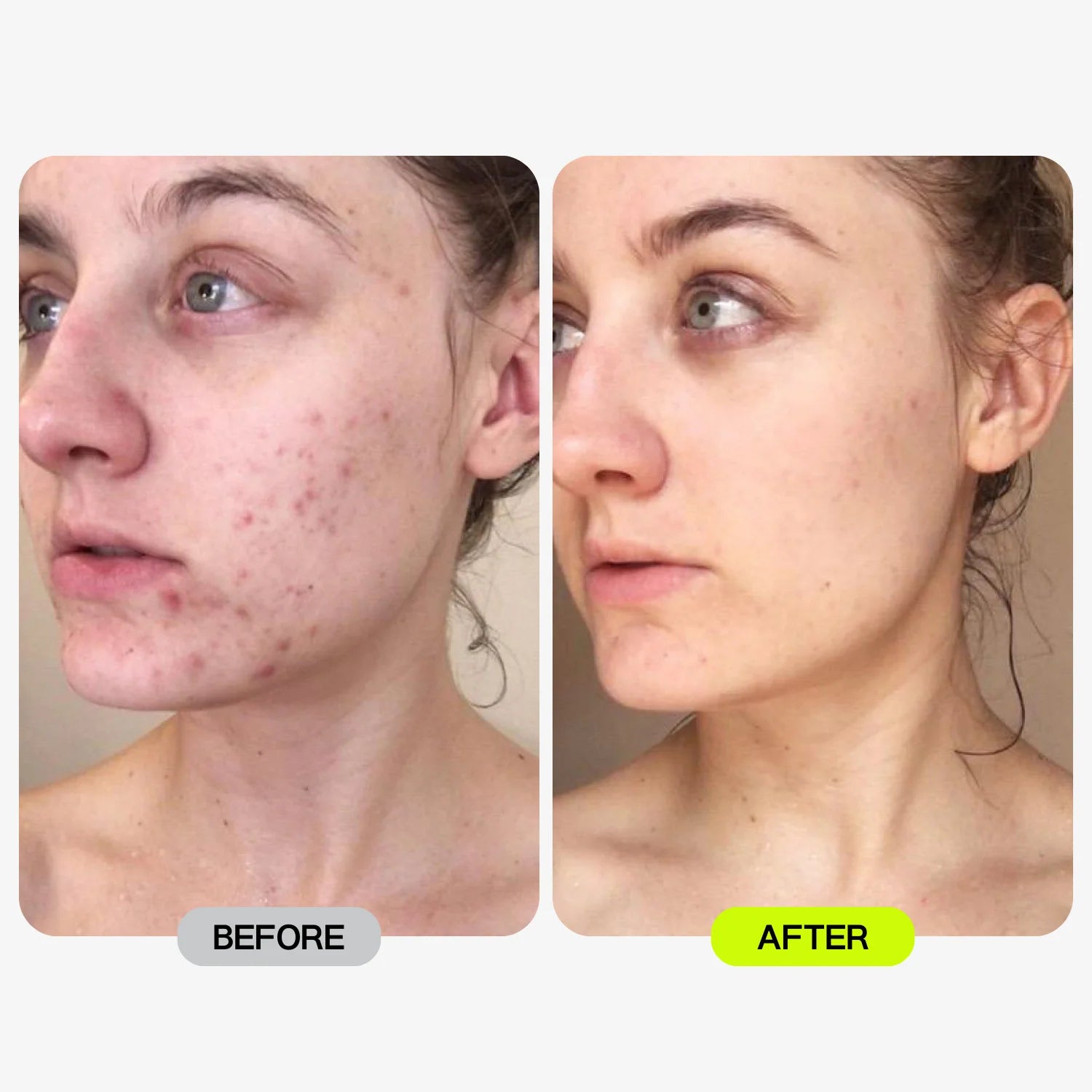 Glotech™ Pro Mask + Collar