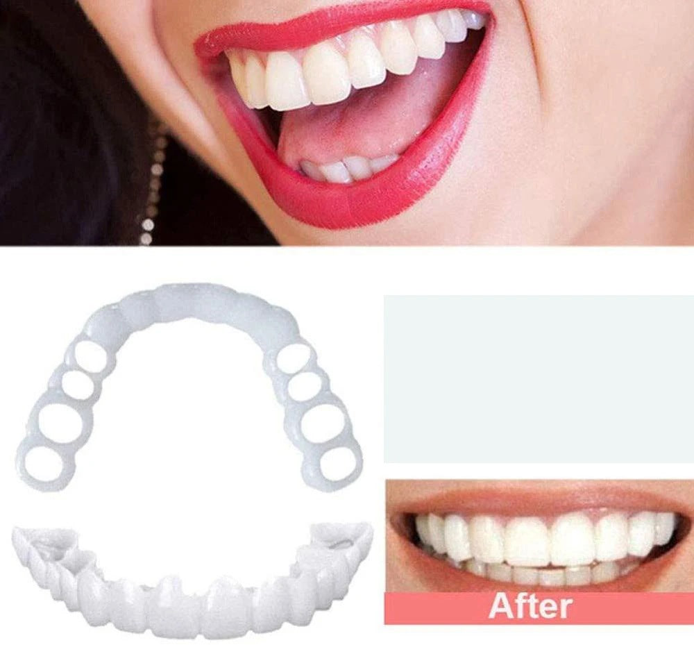 Snap-On Smile 2nd Gen Silicone Whitening Dentures