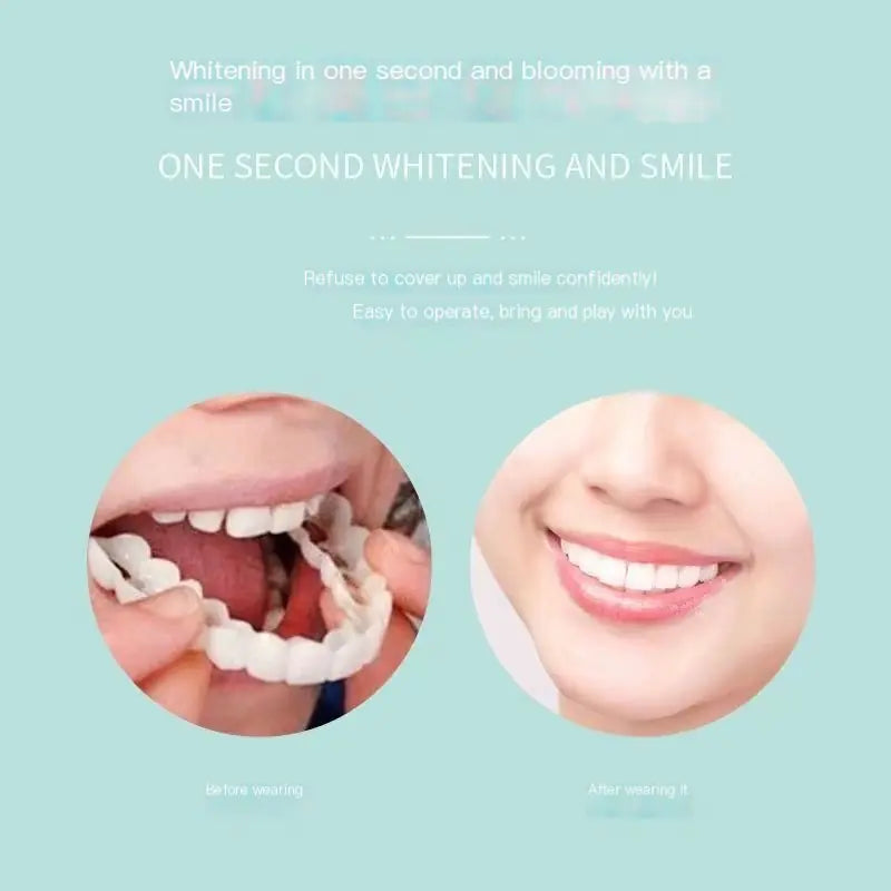 Snap-On Smile 2nd Gen Silicone Whitening Dentures