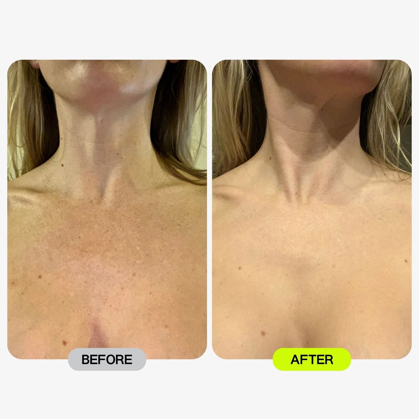 Glotech™ Pro Mask + Collar
