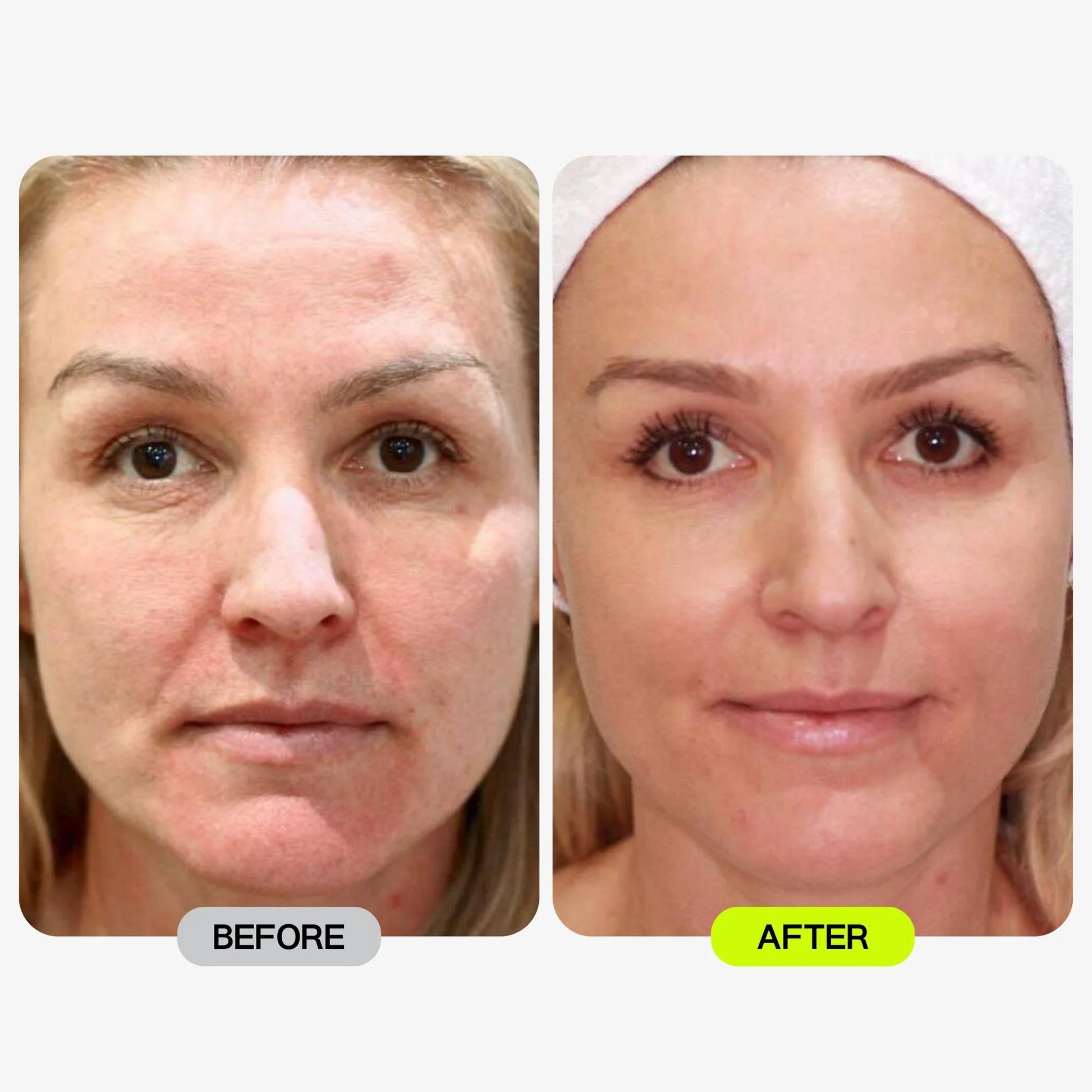Glotech™ Pro Mask + Collar