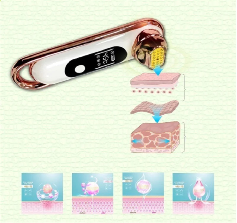 RF Beauty Device for Firming, Whitening, and Skin Care